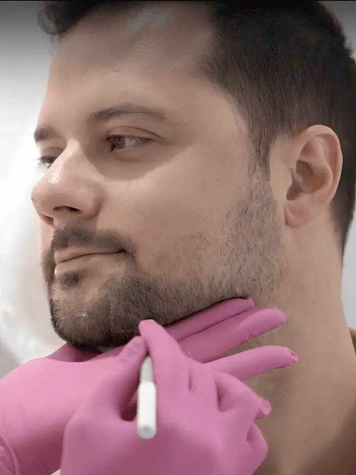 Harmonização Facial